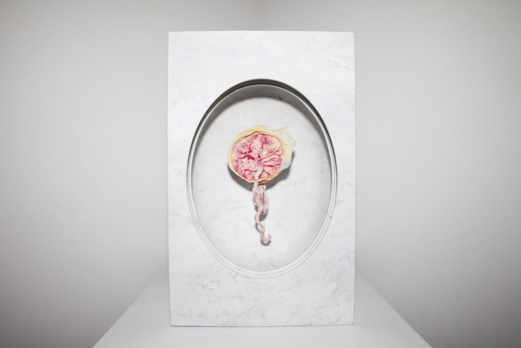 Contemporary abstract art of a plastinated placenta incased in marble shows the life giving and life taking qualities of this organ.